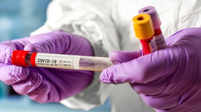 У Польщі зафіксували спалах Covid-19 серед заробітчан з України
