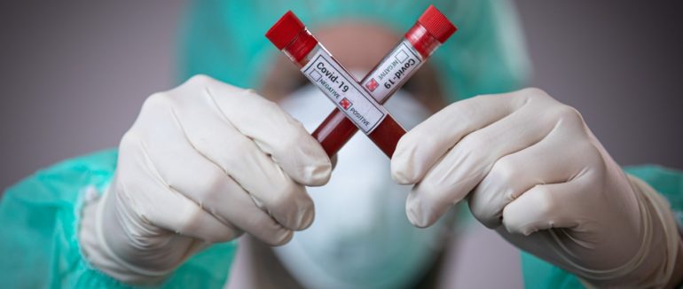 Неможливо повірити: 7 небезпечних фейків про коронавірус