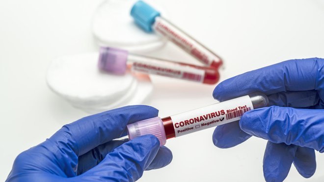 1 433 нових інфікованих: кількість хворих в Україні на Covid-19 наблизилась до 85 тисяч