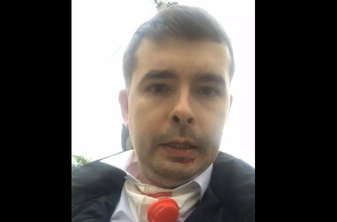 В Ужгороді жорстоко побили кандидата в депутати Ужгородської міської ради