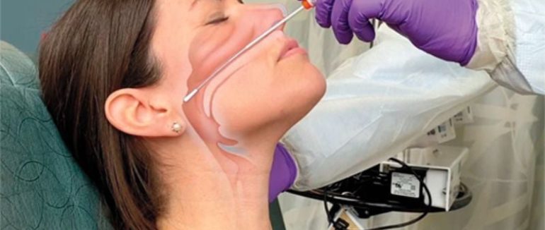 Закарпаття отримало першу партію швидких тестів для діагностики COVID-19