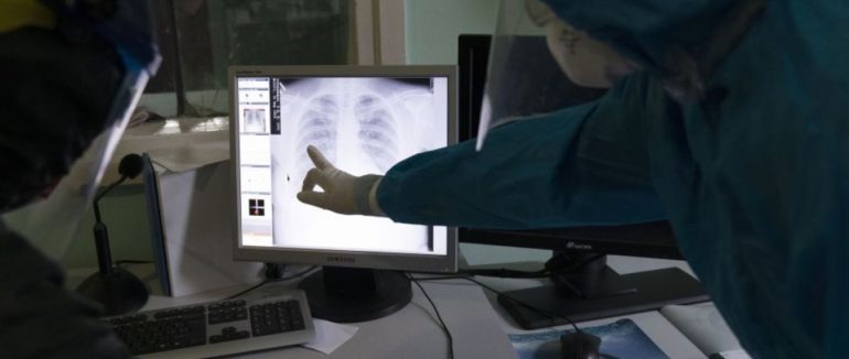 Чи може пневмонія у разі коронавірусу перебігати без температури: відповідь лікаря