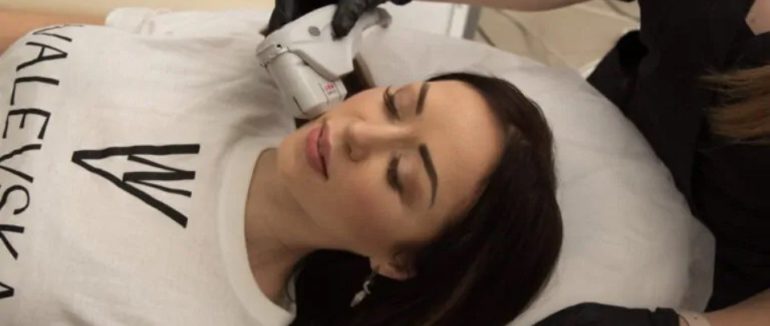 Все про ліфтинг обличчя: типи процедур і коли робити