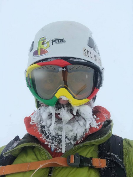 Вражаюче фото: чоловік показав фото свого обмороженого обличчя на 22-й годині рятувальної операції в горах Закарпаття