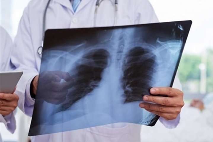 Симптом коронавірусу виявився ознакою іншого небезпечного захворювання