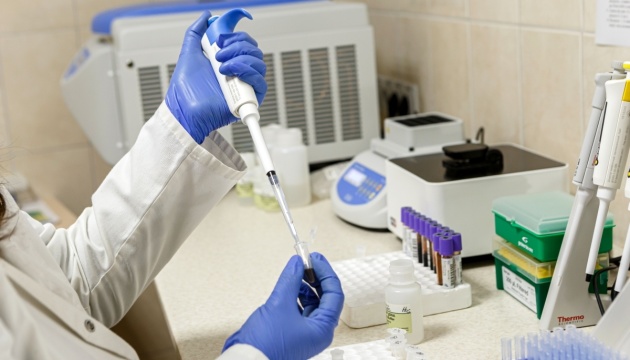 Аналіз безкоштовний: МОЗ закликає українців більше тестуватися