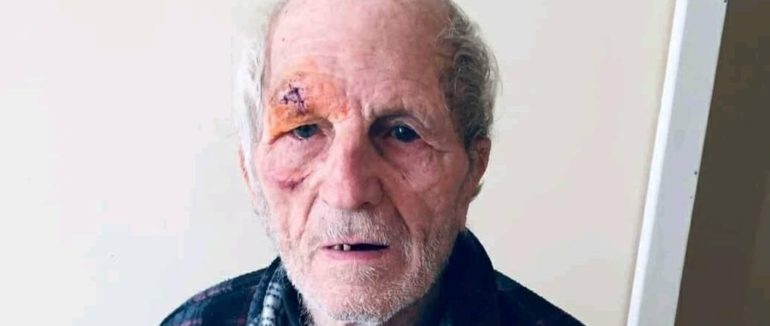 На Закарпатті побитий дідусь чекає на своїх родичів у лікарні