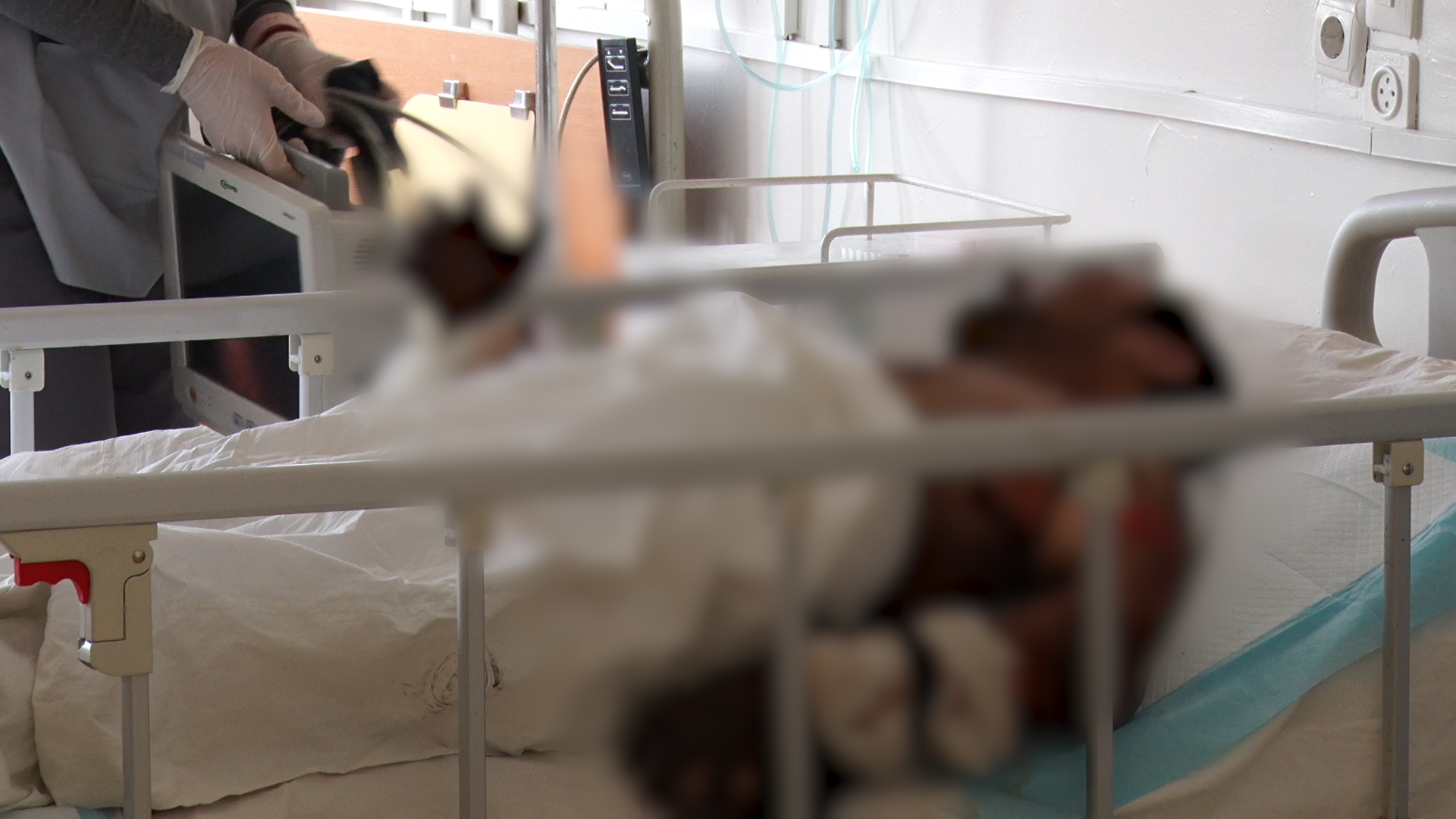 Спалював сухостій: житель Горінчева отримав важкі опіки