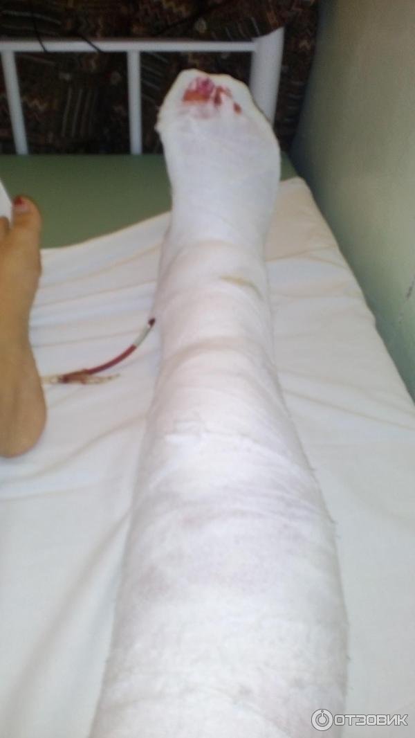 Вчора мукачівка потрапила у біду: поблизу “Зеленого ринку” відбулась аварія