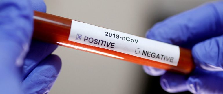 Коронавірусна статистика: на Закарпатті майже 4 сотні нових випадків