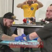 Своєрідний безключовий доступ: українець вшив у себе вісім чіпів