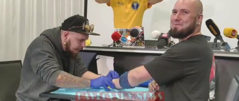 Своєрідний безключовий доступ: українець вшив у себе вісім чіпів