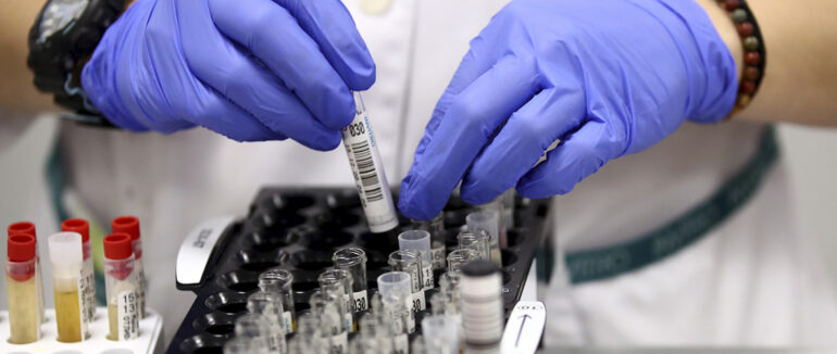 Четверо закарпатців померли за добу: статистика COVID-19 на Закарпатті