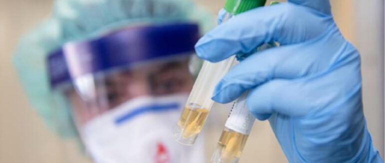 За добу більше 20 випадків, двоє пацієнтів померли: статистика COVID-19 на Закарпатті