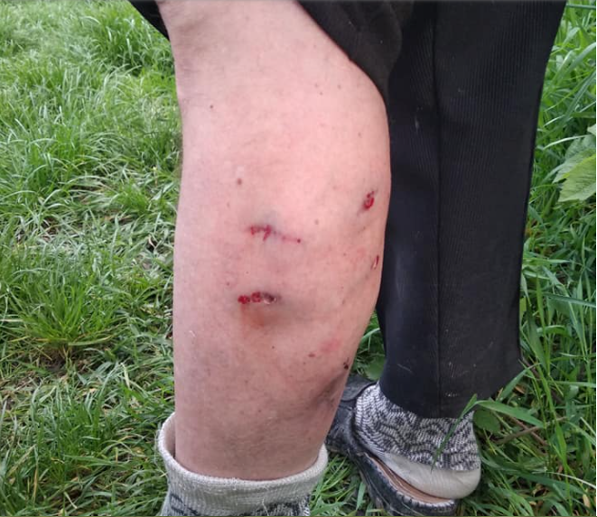 В Мукачеві на літню жінку напала безпритульна собака