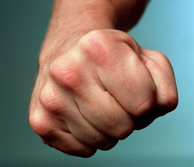 В Ужгороді серед дня невідомий напав на студента УжНУ