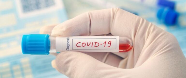 3 нові випадки за добу в Ужгороді: оновлена статистика станом на сьогодні