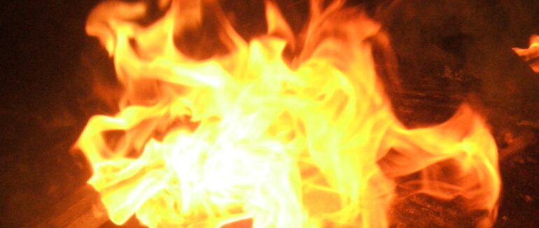 Отримав опіки від палаючої сорочки: на Хустщині чоловіка госпіталізували до лікарні