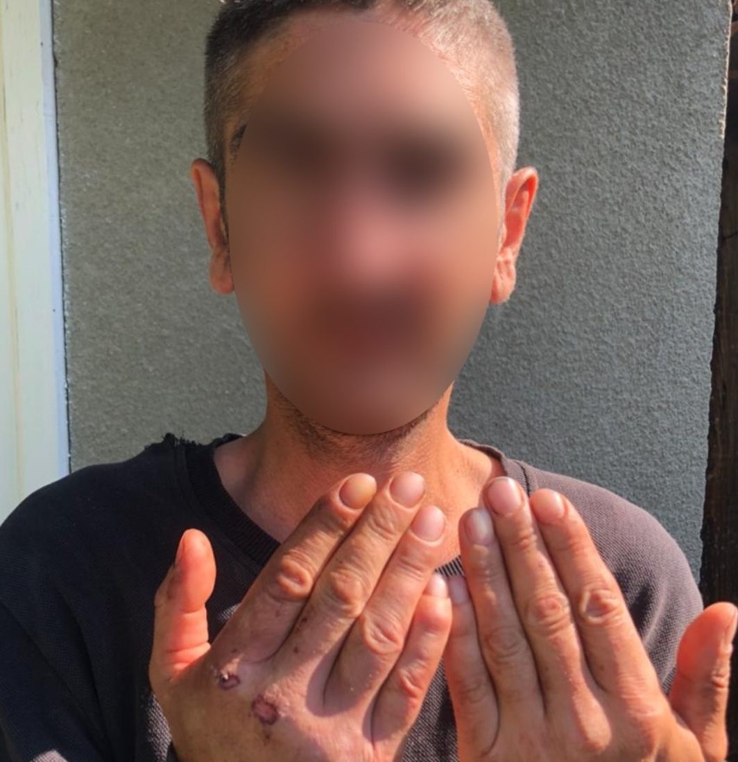 Алкогольна сварка переросла в бійку: на Тячівщині чоловік жорстоко побив товариша та залишив його просто на вулиці