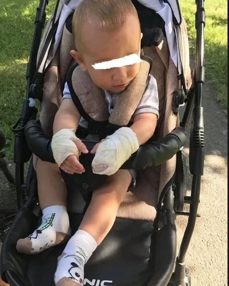 Нещасний випадок у Мукачеві: хлопчик на дитячому майданчику отримав опіки рук – СОЦМЕРЕЖІ