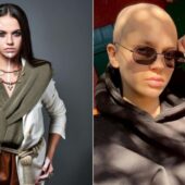 Закарпатська відома гімнастка поборола рак