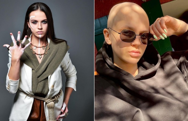 Закарпатська відома гімнастка поборола рак