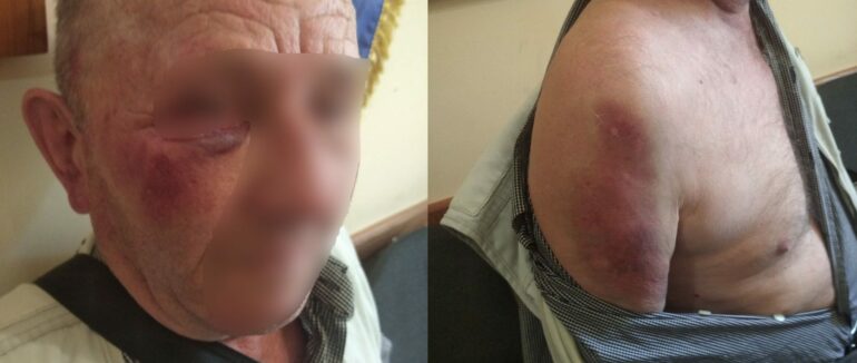 На Мукачівщині молодики побили та пограбували пенсіонера в його ж будинку: нападникам загрожує від 4 до 8 років ув’язнення