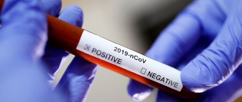 10 нових випадків за добу: статистика COVID-19 в Ужгороді станом на сьогодні