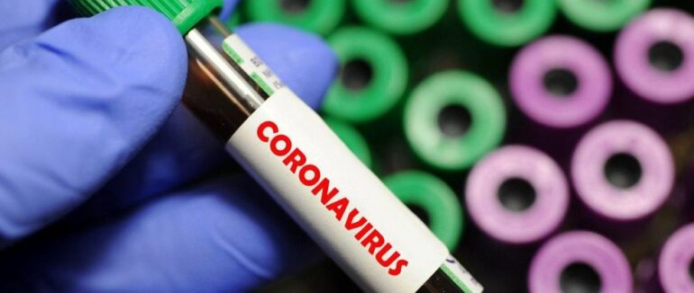 На Закарпатті COVID-19 діагностували в 46 людей – оновлено