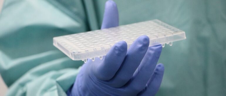 Майже 20 людей захворіли за минулу добу: статистика COVID-19 в Ужгороді