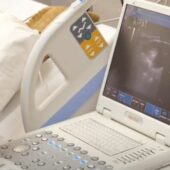 Повернення до життя: тромболізис як сучасний метод у лікуванні інсульту (ФОТО, ВІДЕО)