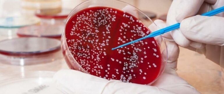 На Закарпатті у 28 працівників їдалень  освіти виявили стафілококом