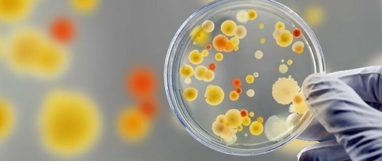 Стафілокок на Закарпатті: майже у 70 працівників їдалень виявили бактерію