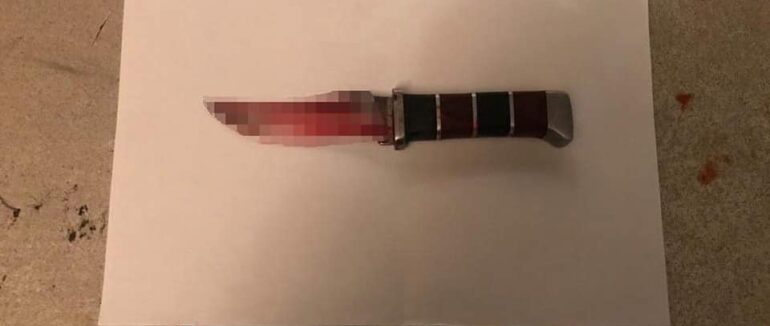 Вночі в Ужгородському районі  жінка намагалася вбити чоловіка