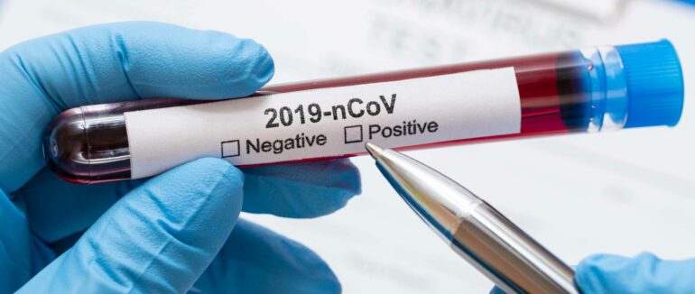 У Мукачеві за останні 2 тижні від ковіду померло більше 30 людей