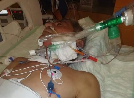 У Чехії на заробітках жорстоко побили закарпатця: рідні благають про допомогу