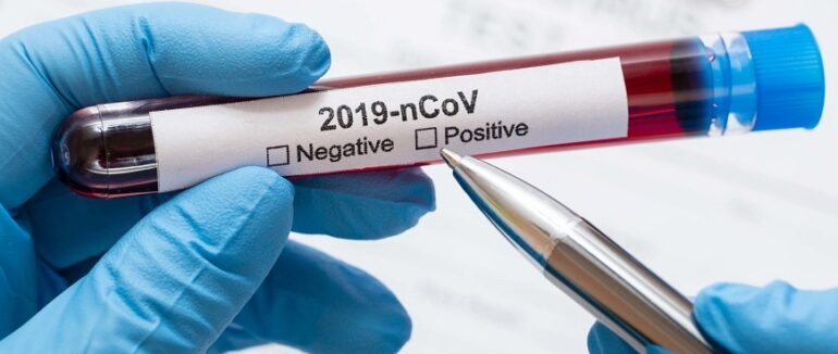 За добу на Закарпатті виявили 111 випадків COVID-19 та померло 4 хворих