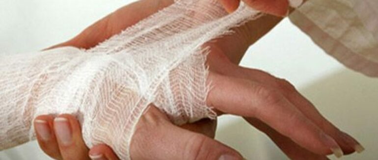 В Хустському районі жінка отримала 80% опіків тілам у власному будинку