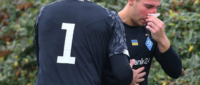 Потрібна операція: відомий футболіст з Мукачева отримав серйозну травму під час матчу