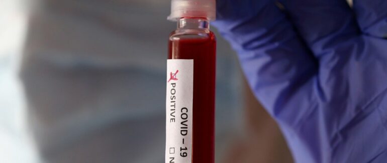 На Закарпатті упродовж доби померли дев’ять людей з COVID-19