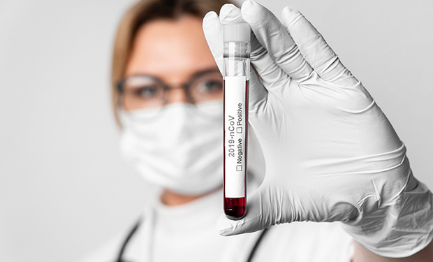 За добу на Закарпатті підтверджено 482 випадки COVID-19 та 5 людей померло