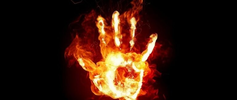 В Ужгороді горіла занедбана будівля: чоловік отримав опіки