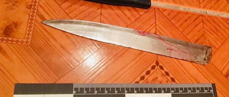 Закарпатку ледь не вбили в Івано-Франківську: що відомо