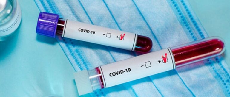 На Закарпатті за добу виявили понад 350 випадків COVID-19