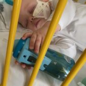 Маленький мукачівець бореться з важкою недугою: батьки благають про допомогу