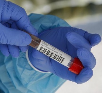 На Закарпатті за добу виявили 472 випадки COVID-19, померло 11 пацієнтів