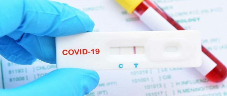 385 нових випадків за добу, 4 хворих померли: статистика COVID-19 на Закарпатті