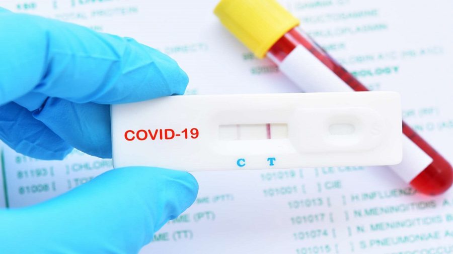385 нових випадків за добу, 4 хворих померли: статистика COVID-19 на Закарпатті