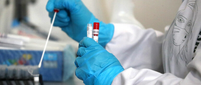 За минулу добу 795 випадків,10 хворих – померли: оновлена статистика COVID-19 на Закарпатті