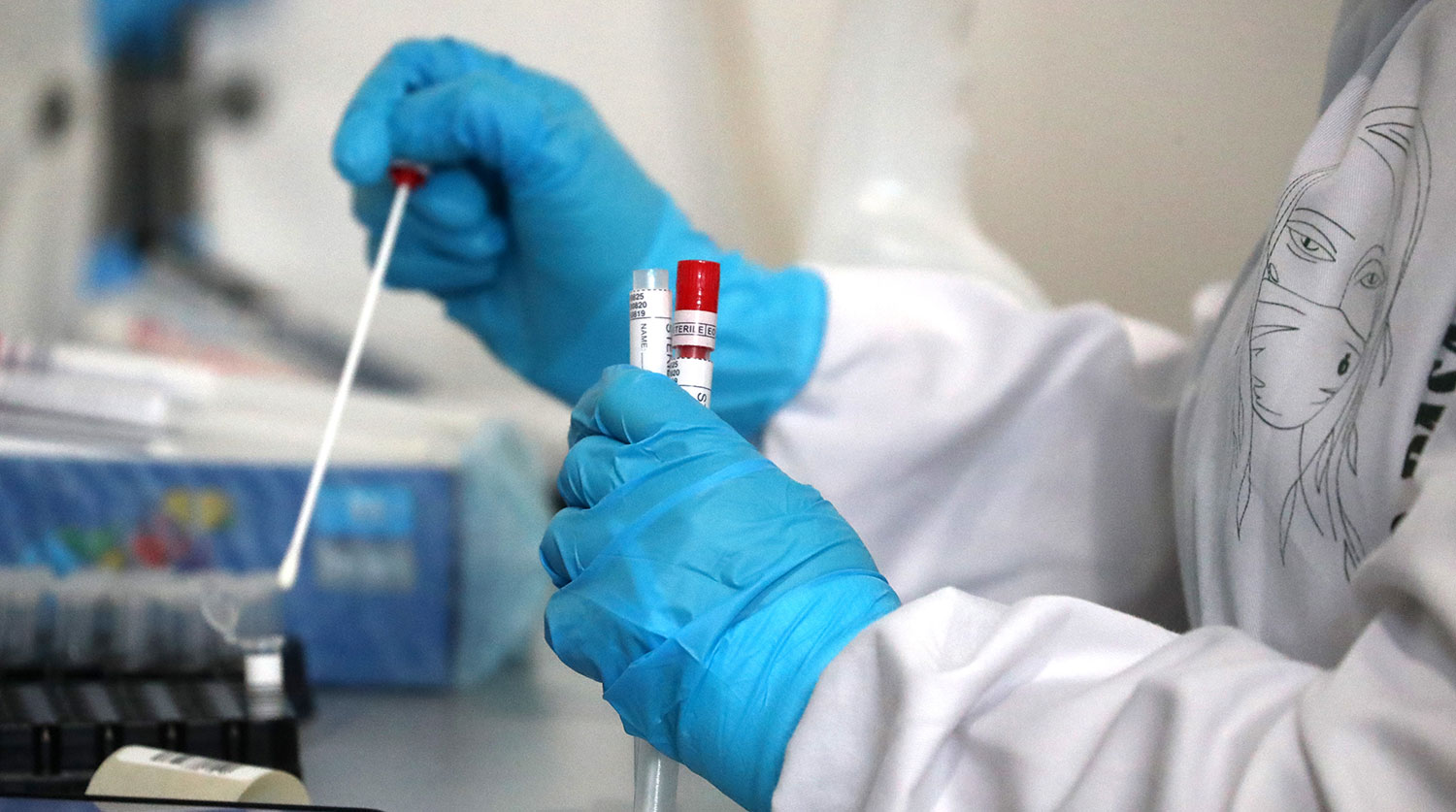 За минулу добу 795 випадків,10 хворих - померли: оновлена статистика COVID-19 на Закарпатті
